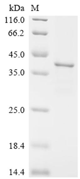 (Tris-Glycine gel) Discontinuous SDS-PAGE (reduced) with 5% enrichment gel and 15% separation gel.