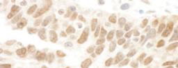 Detection of human Abraxas by immunohistochemistry.