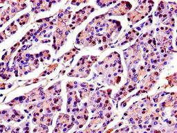 Immunohistochemistry of paraffin-embedded human pancreatic tissue using CSB-PA022575LA01HU at dilution of 1:100