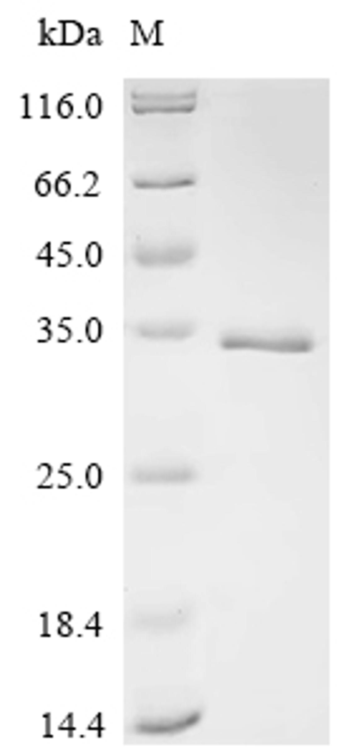 (Tris-Glycine gel) Discontinuous SDS-PAGE (reduced) with 5% enrichment gel and 15% separation gel.