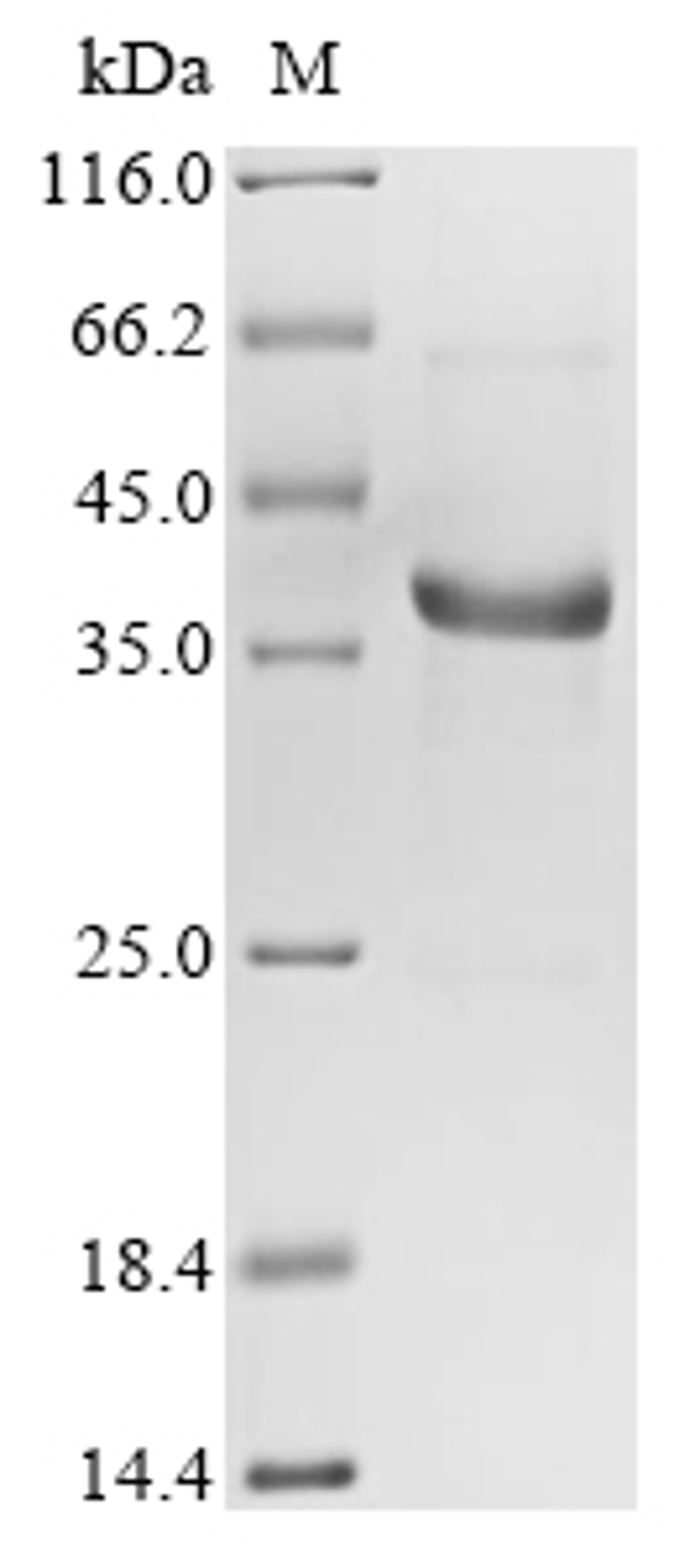 (Tris-Glycine gel) Discontinuous SDS-PAGE (reduced) with 5% enrichment gel and 15% separation gel.