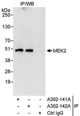 Detection of human MEK2 by western blot of immunoprecipitates.