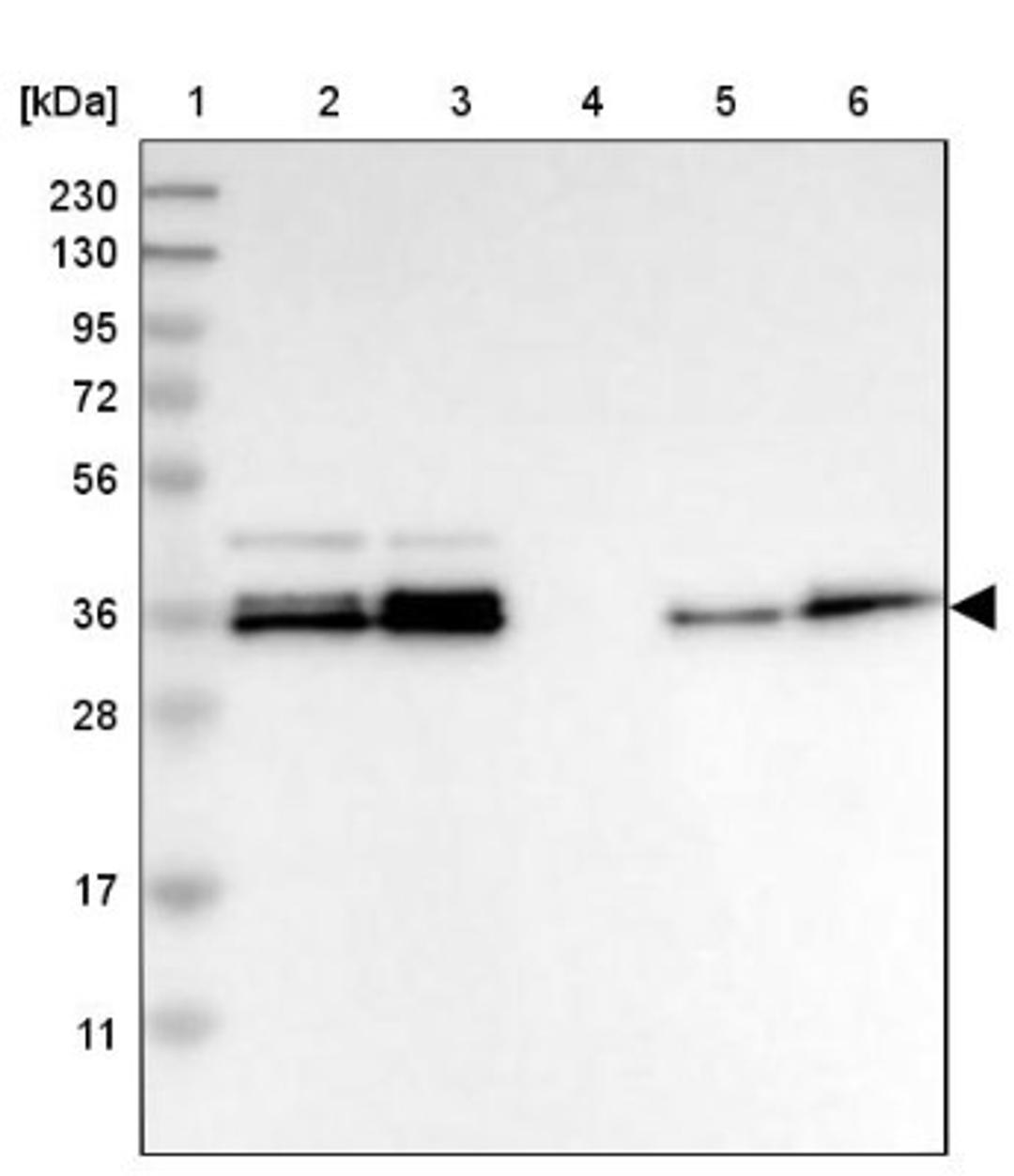 Western Blot: CALHM3 Antibody [NBP1-88802] - Lane 1: Marker [kDa] 230, 130, 95, 72, 56, 36, 28, 17, 11<br/>Lane 2: Human cell line RT-4<br/>Lane 3: Human cell line U-251MG sp<br/>Lane 4: Human plasma (IgG/HSA depleted)<br/>Lane 5: Human liver tissue<br/>Lane 6: Human tonsil tissue