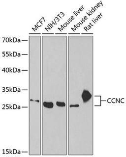 Western blot - CCNC antibody (A6545)