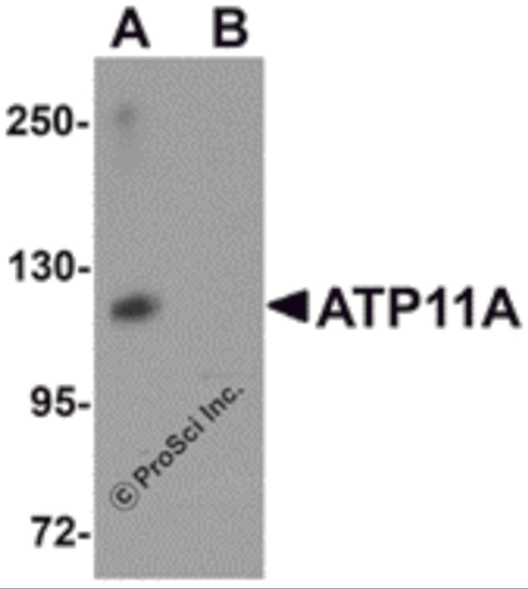 Western blot analysis of ATP11A in K562 cell tissue lysate with ATP11A antibody at 1 μg/mL in (A) the absence and (B) the presence of blocking peptide.