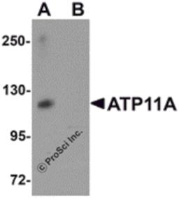 Western blot analysis of ATP11A in K562 cell tissue lysate with ATP11A antibody at 1 μg/mL in (A) the absence and (B) the presence of blocking peptide.