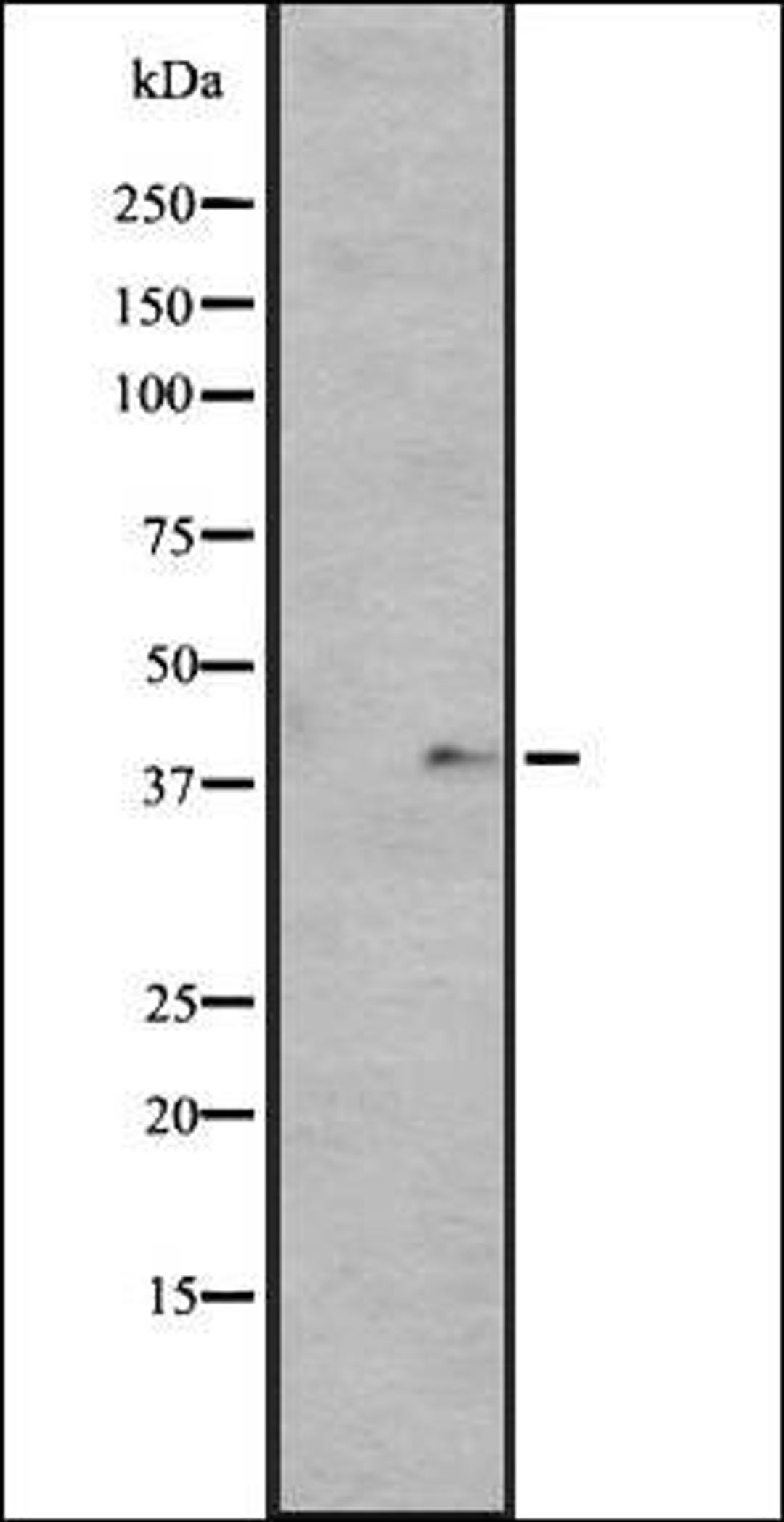 Western blot analysis of HUVEC cell lysate using GPR136 antibody