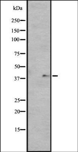 Western blot analysis of HUVEC cell lysate using GPR136 antibody