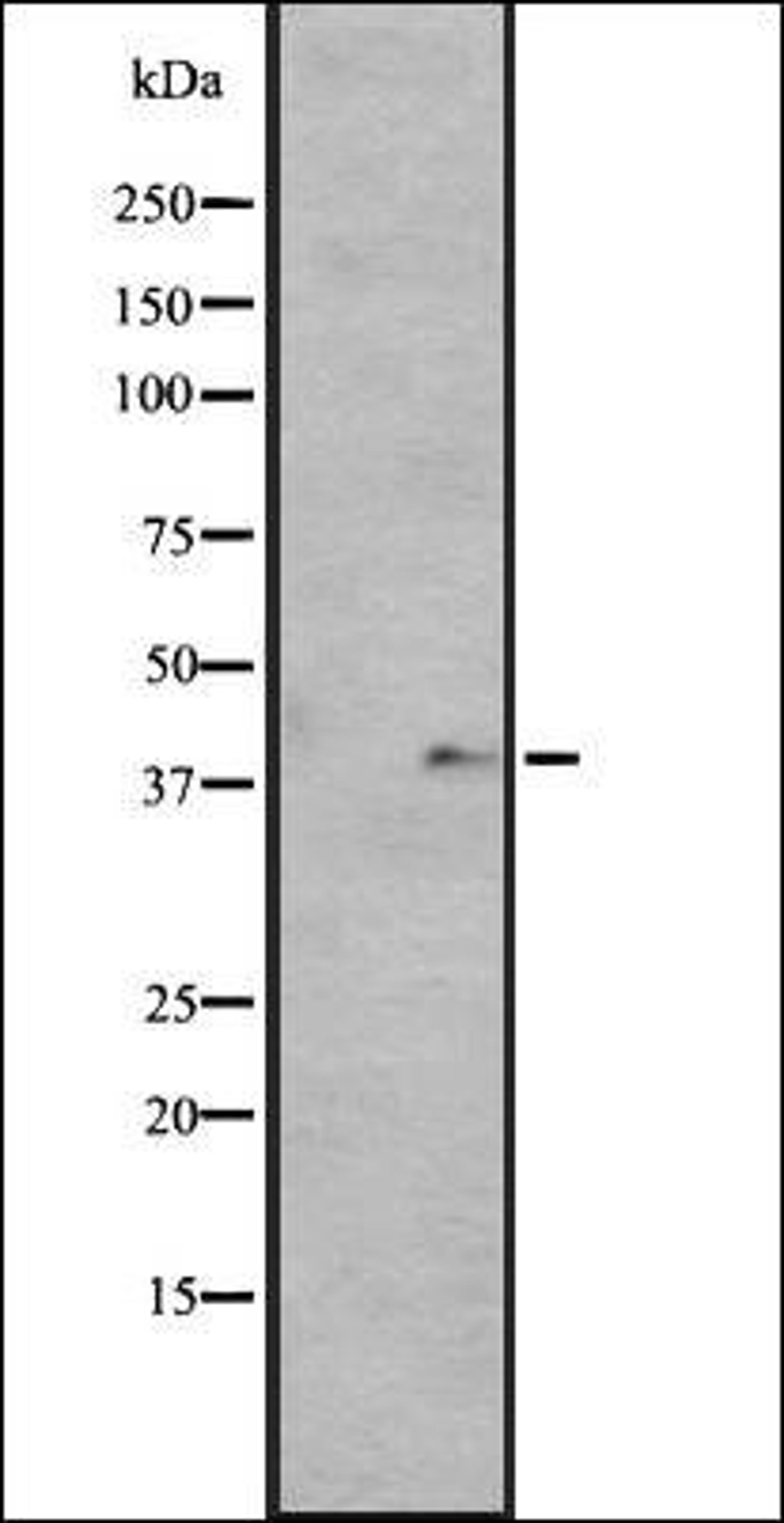 Western blot analysis of HUVEC cell lysate using GPR136 antibody