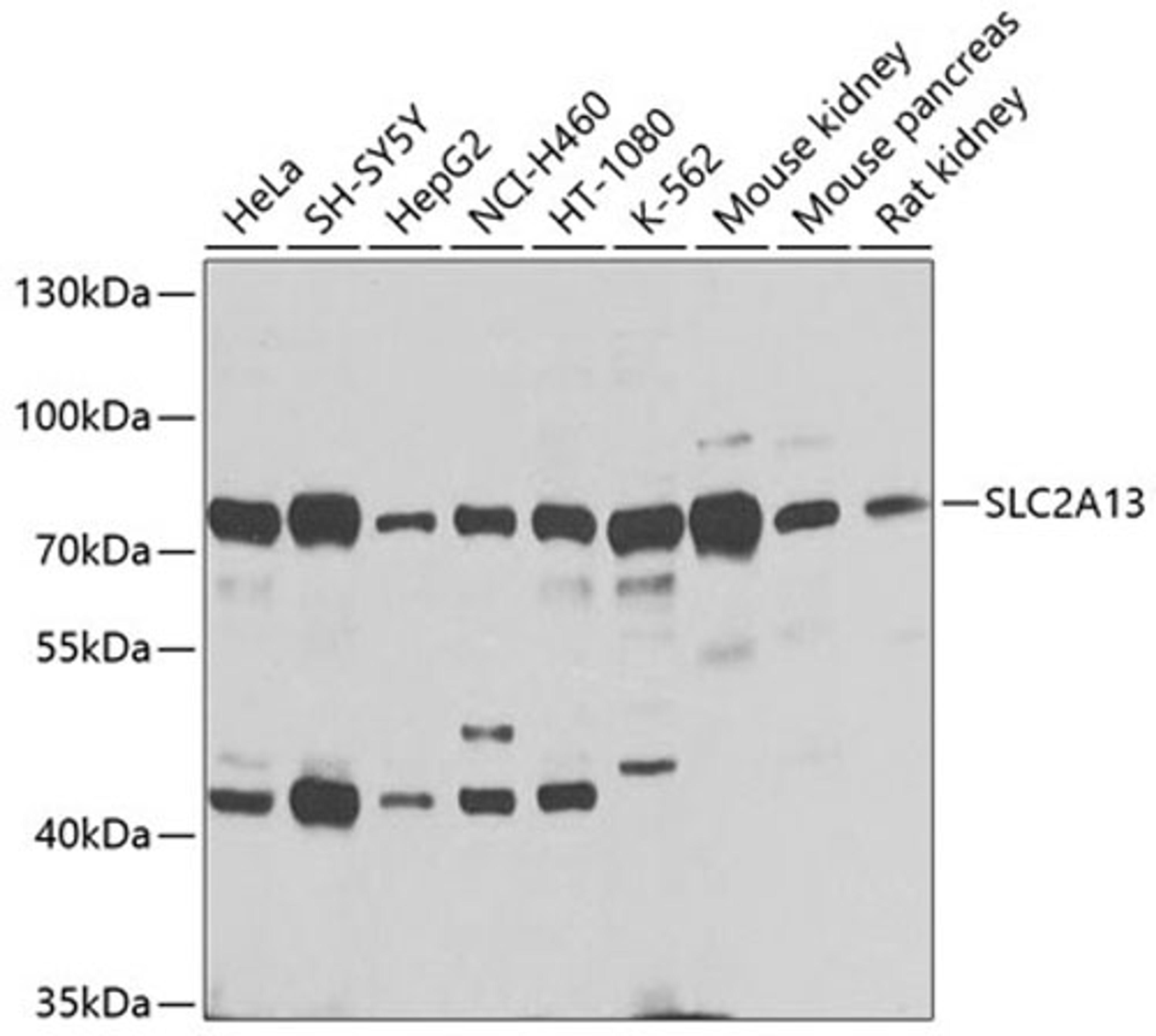 Western blot - SLC2A13 antibody (A9993)