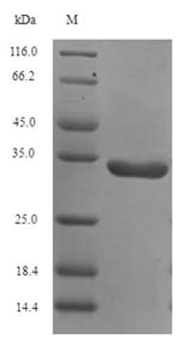 (Tris-Glycine gel) Discontinuous SDS-PAGE (reduced) with 5% enrichment gel and 15% separation gel.