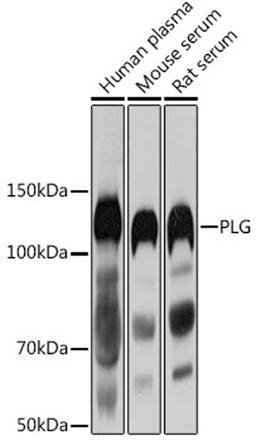 Western blot - PLG antibody (A3320)