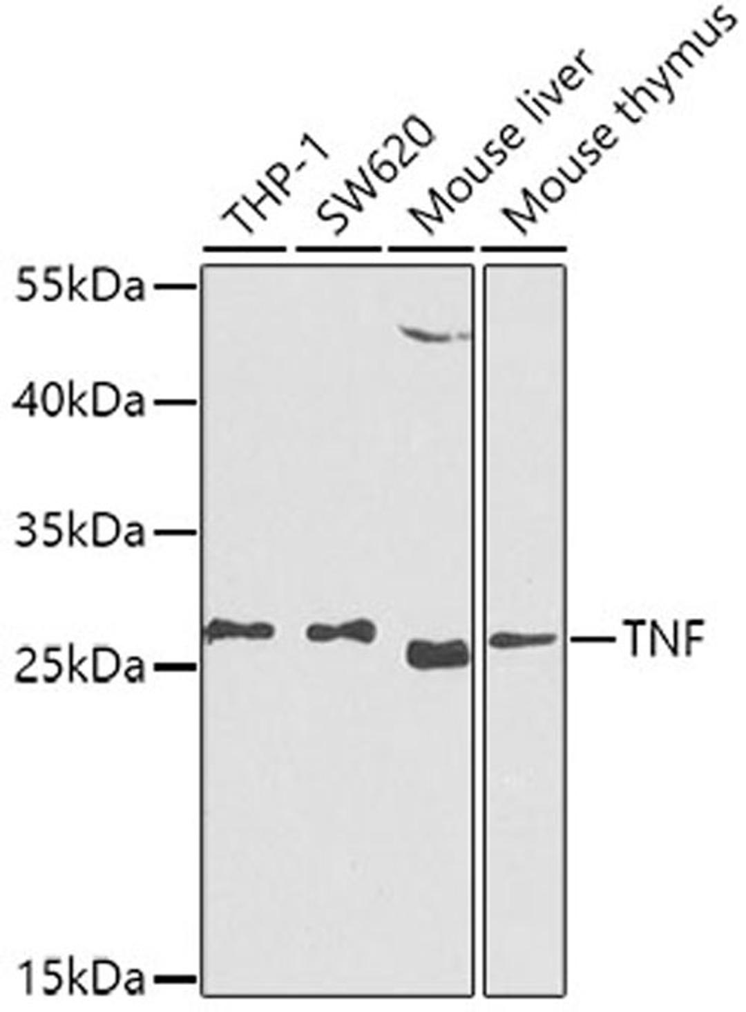 Western blot - TNF-a antibody (A0277)