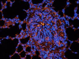 Immunofluorescence image of guinea pig lung tissue using Aquaporin 1 antibody (2.5 ug/ml)