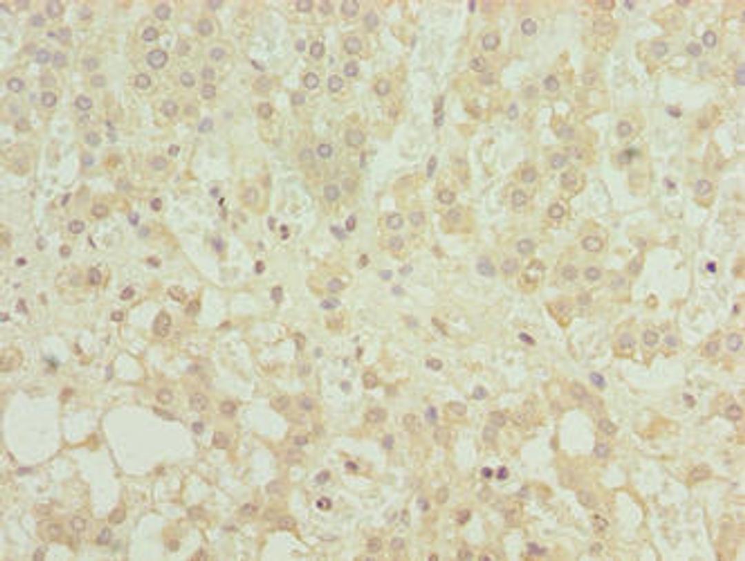 Immunohistochemistry of paraffin-embedded human adrenal gland tissue using CSB-PA844087LA01HU at dilution of 1:100