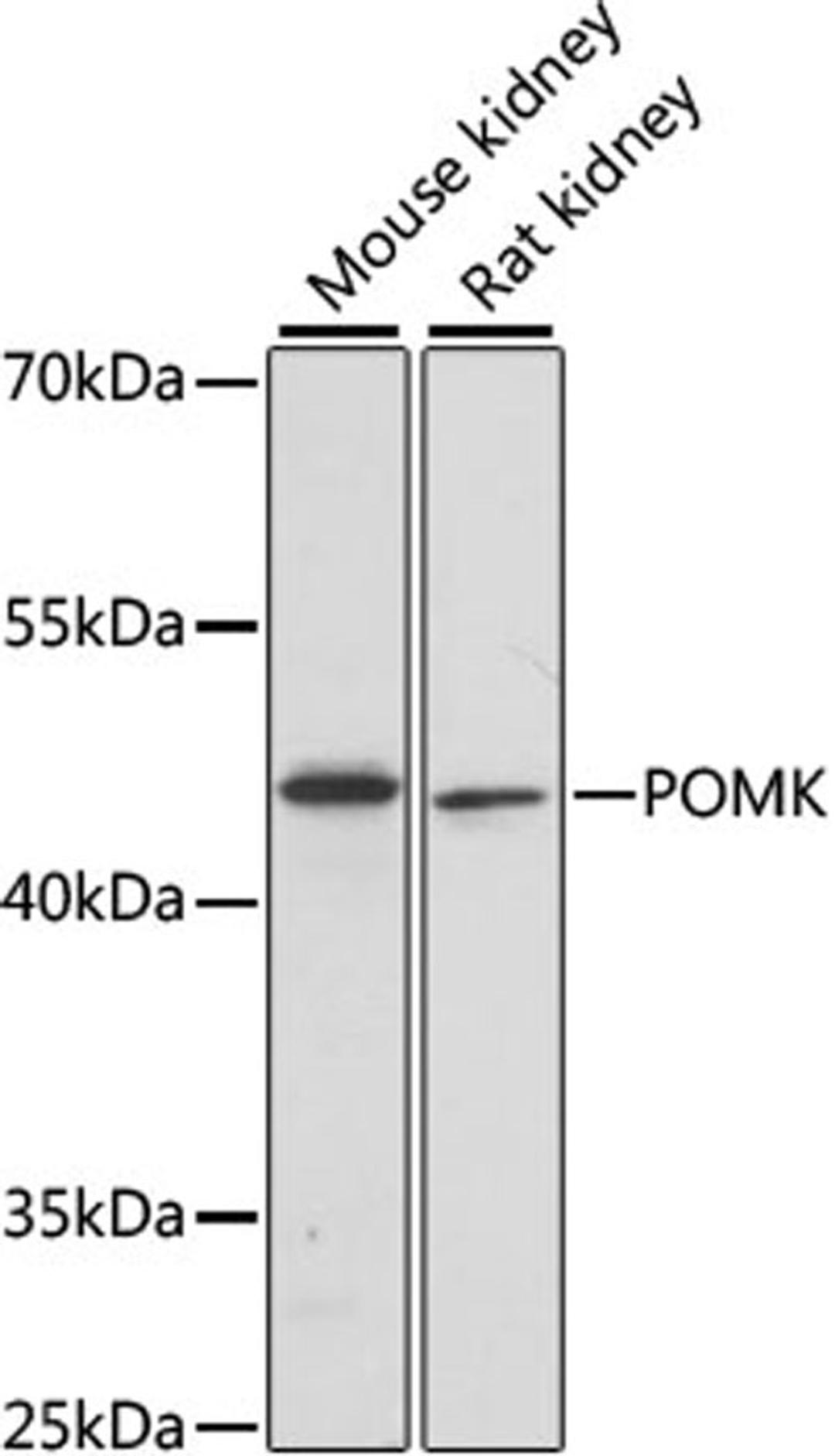 Western blot - POMK antibody (A15529)