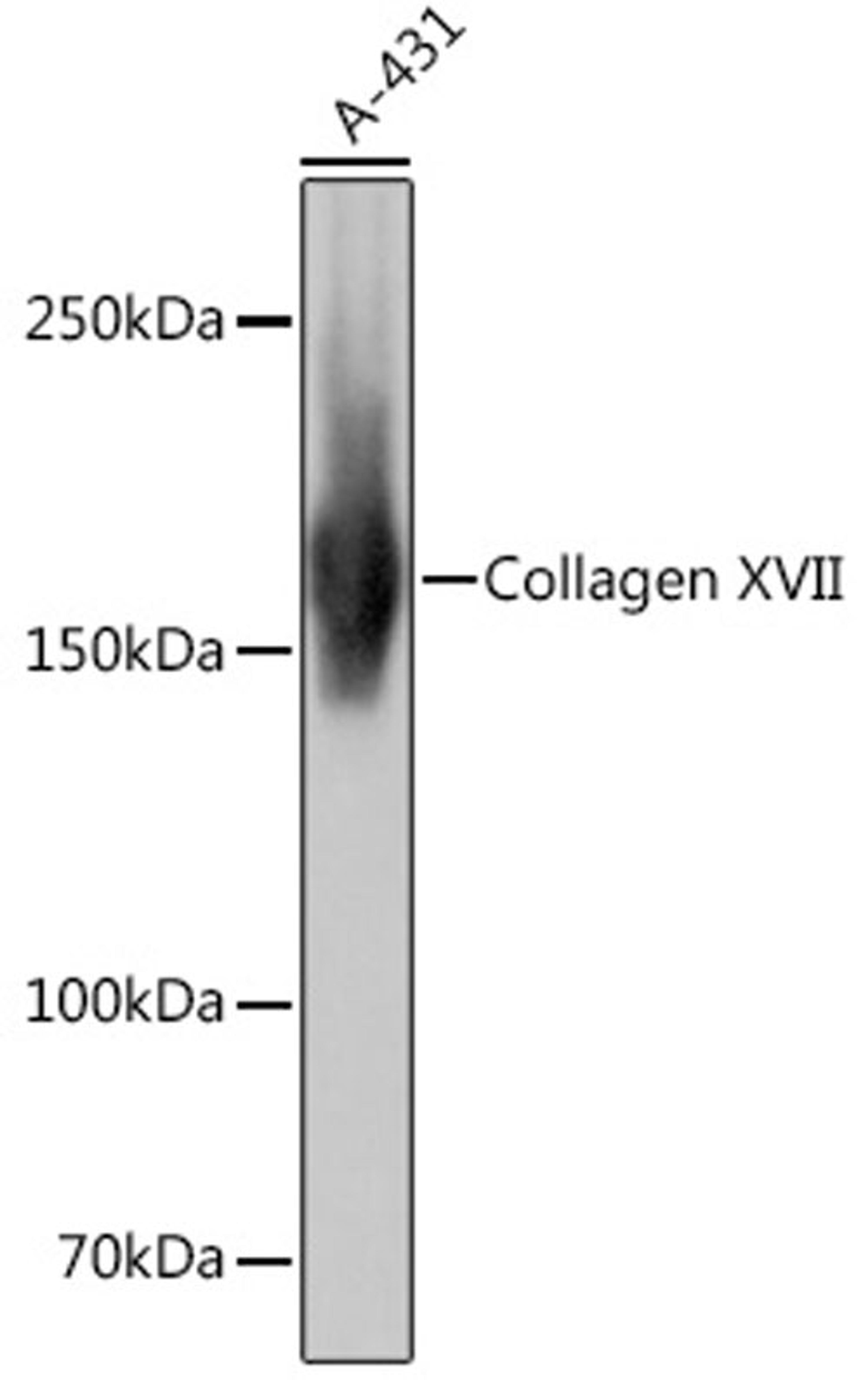 Western blot - Collagen XVII Rabbit mAb (A4808)