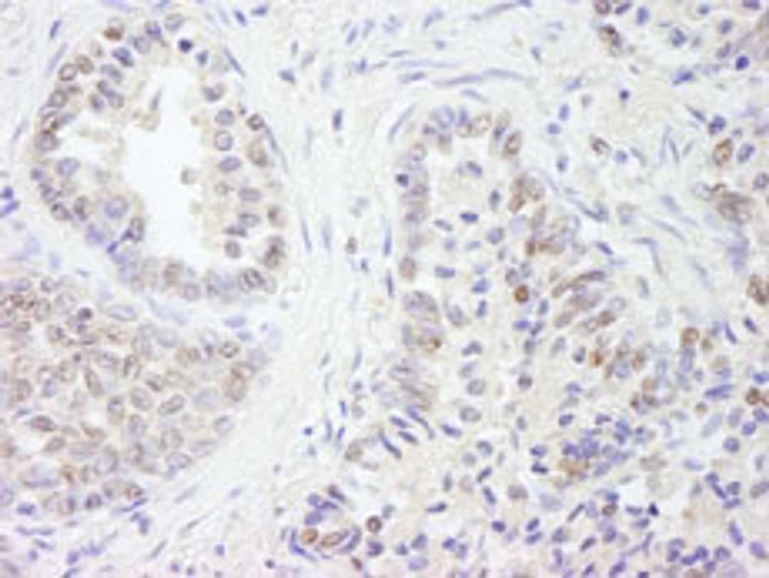 Detection of human UBE1 by immunohistochemistry.