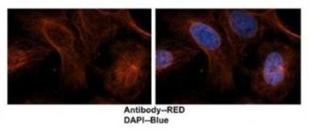 Immunocytochemistry/Immunofluorescence: TUBA6 Antibody [NBP1-79850] - Human brain stem cells, antibody concentration 2 ug/ml.