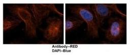 Immunocytochemistry/Immunofluorescence: TUBA6 Antibody [NBP1-79850] - Human brain stem cells, antibody concentration 2 ug/ml.