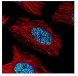 Immunocytochemistry/Immunofluorescence: Alpha Actinin 4 Antibody [NBP2-15357] - Paraformaldehyde-fixed HeLa, using alpha Actinin 4 antibody (Green) at 1:500 dilution. Alpha-tubulin filaments were labeled with an alpha Tubulin antibody (Red) at 1:2000.