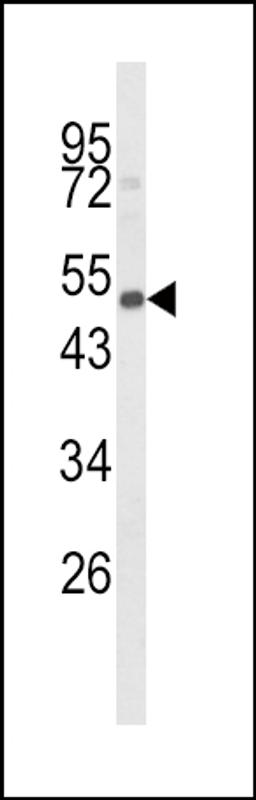 Western blot analysis of CYP24A1 Antibody in mouse spleen tissue lysates (35ug/lane)