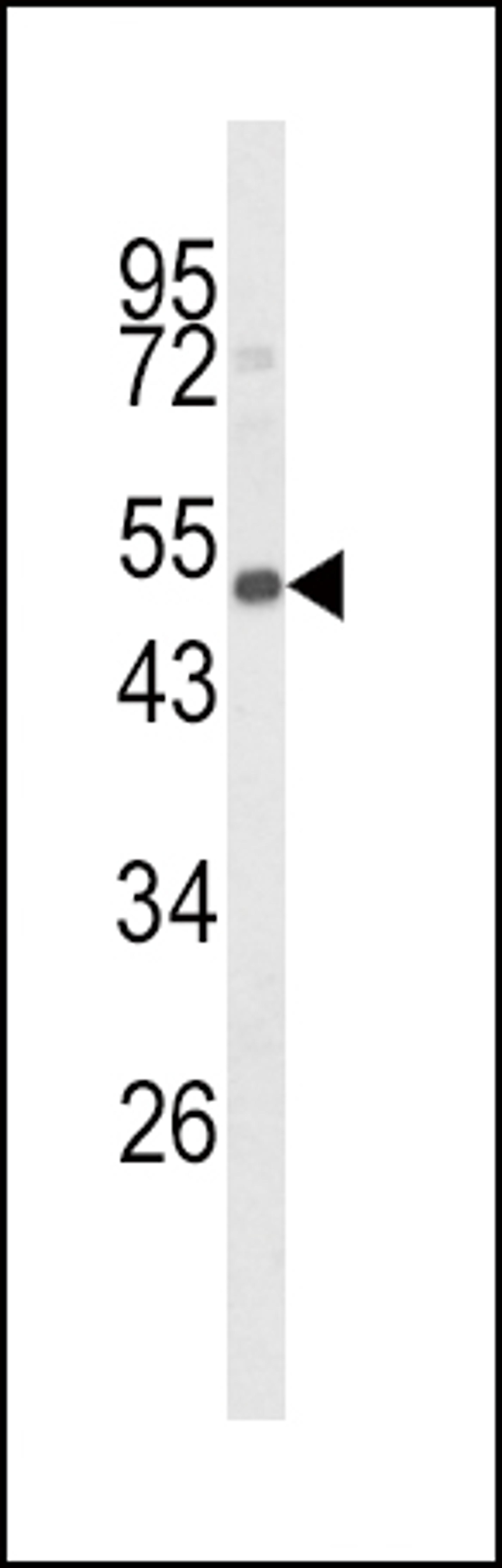 Western blot analysis of CYP24A1 Antibody in mouse spleen tissue lysates (35ug/lane)