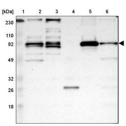 Western Blot: Acetyl CoA synthetase Antibody [NBP1-90276] - Lane 1: Marker [kDa] 230, 110, 82, 49, 32, 26, 18<br/>Lane 2: Human cell line RT-4<br/>Lane 3: Human cell line U-251MG sp<br/>Lane 4: Human plasma (IgG/HSA depleted)<br/>Lane 5: Human liver tissue<br/>Lane 6: Human tonsil tissue