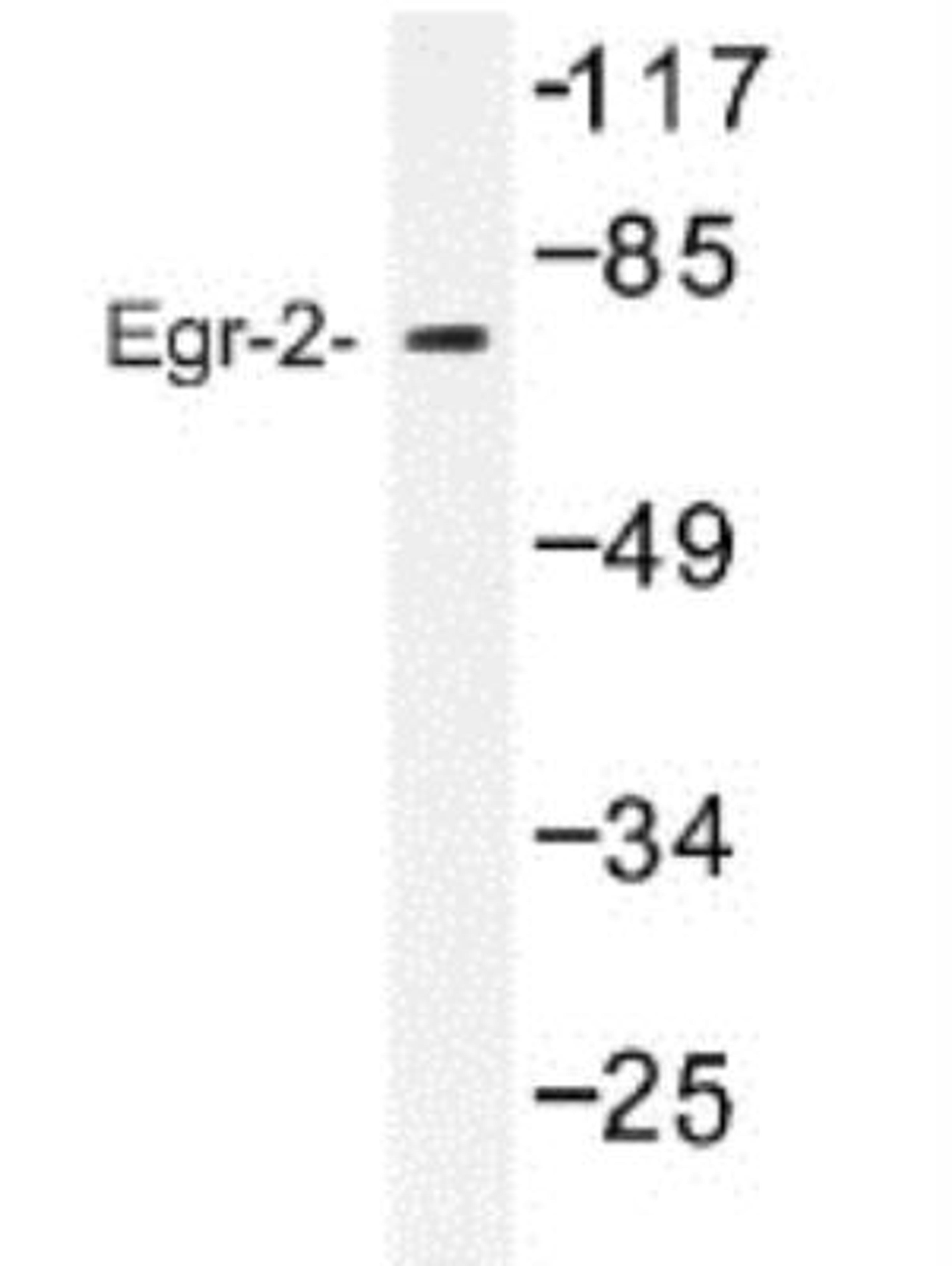 Western Blot: EGR2 Antibody [NB100-92327] - Egr-2 Antibody in extracts from HUVEC cells.