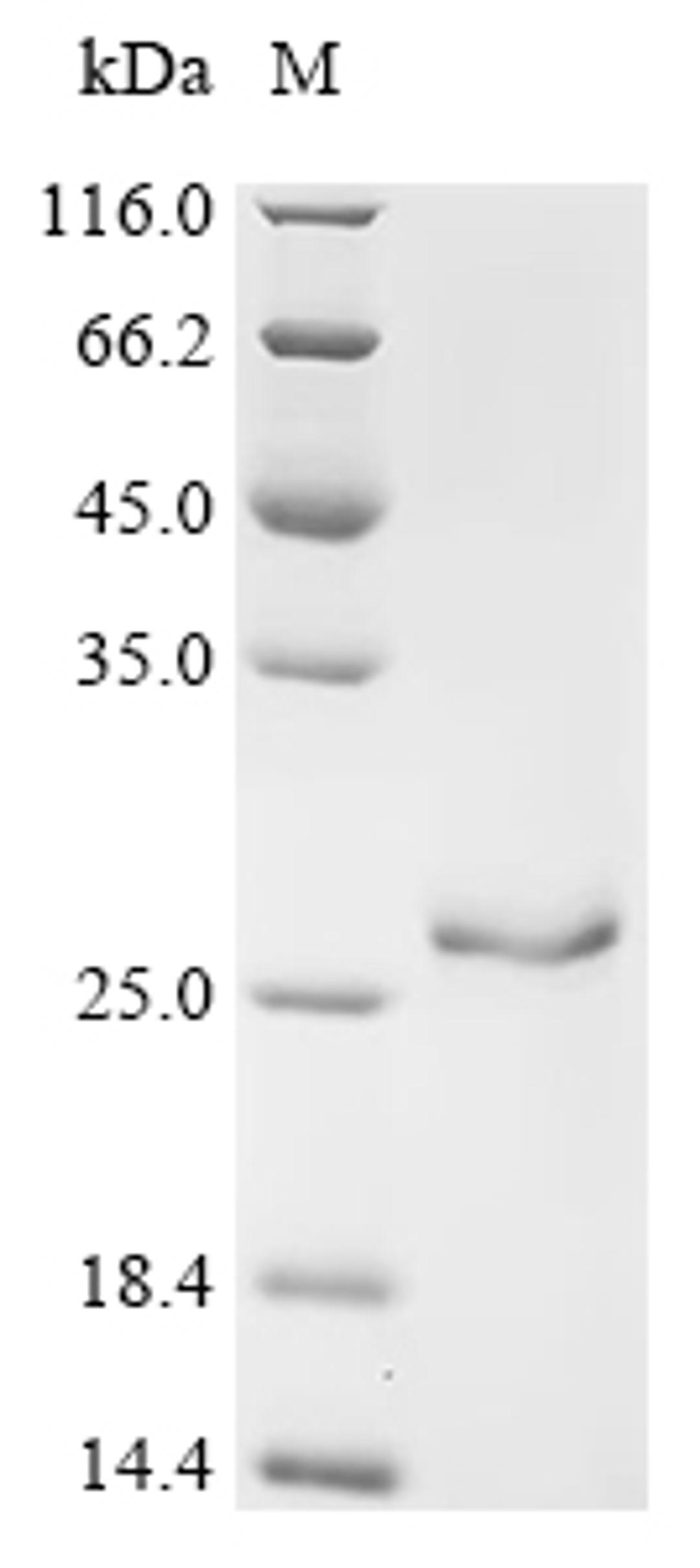 (Tris-Glycine gel) Discontinuous SDS-PAGE (reduced) with 5% enrichment gel and 15% separation gel.
