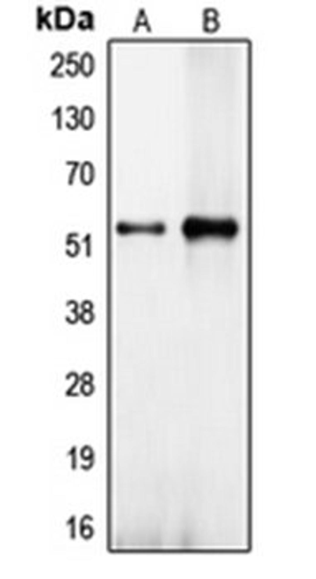 Western blot analysis of NT2D1 (Lane 1), HeLa (Lane 2) whole cell lysates using CEP57 antibody