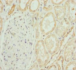 Immunohistochemistry of paraffin-embedded human kidney tissue using CSB-PA881003ESR1HU at dilution of 1:100