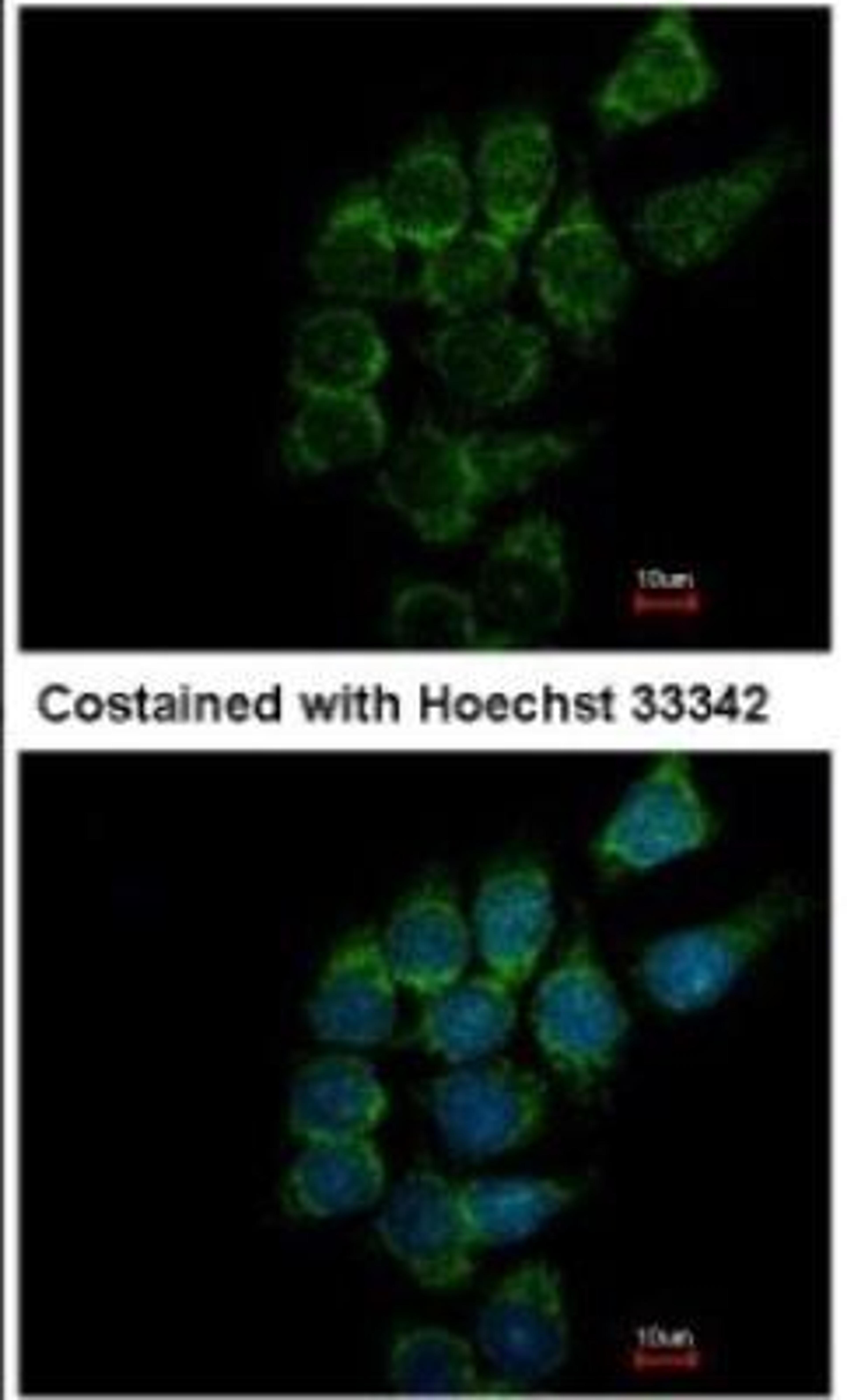 Immunocytochemistry/Immunofluorescence: ST3 beta-Gal alpha-2,3-Sialyltransferase 1/ST3GAL1/SIAT4A Antibody [NBP1-31449] -  Analysis of methanol-fixed Hep3B, using antibody at 1:500 dilution.