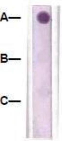 Dot Blot: beta-Catenin [p Tyr96] Antibody [NBP1-73989] -  1 mg peptide was blot onto NC membrane: A: beta-Catenin [p Tyr96] / B: Beta-Catenin (Non-Phospho) / C: Non-related Phosphopeptide. Followed by immunoblotting Rabbit anti-beta-Catenin (pY96) at 1:1000.