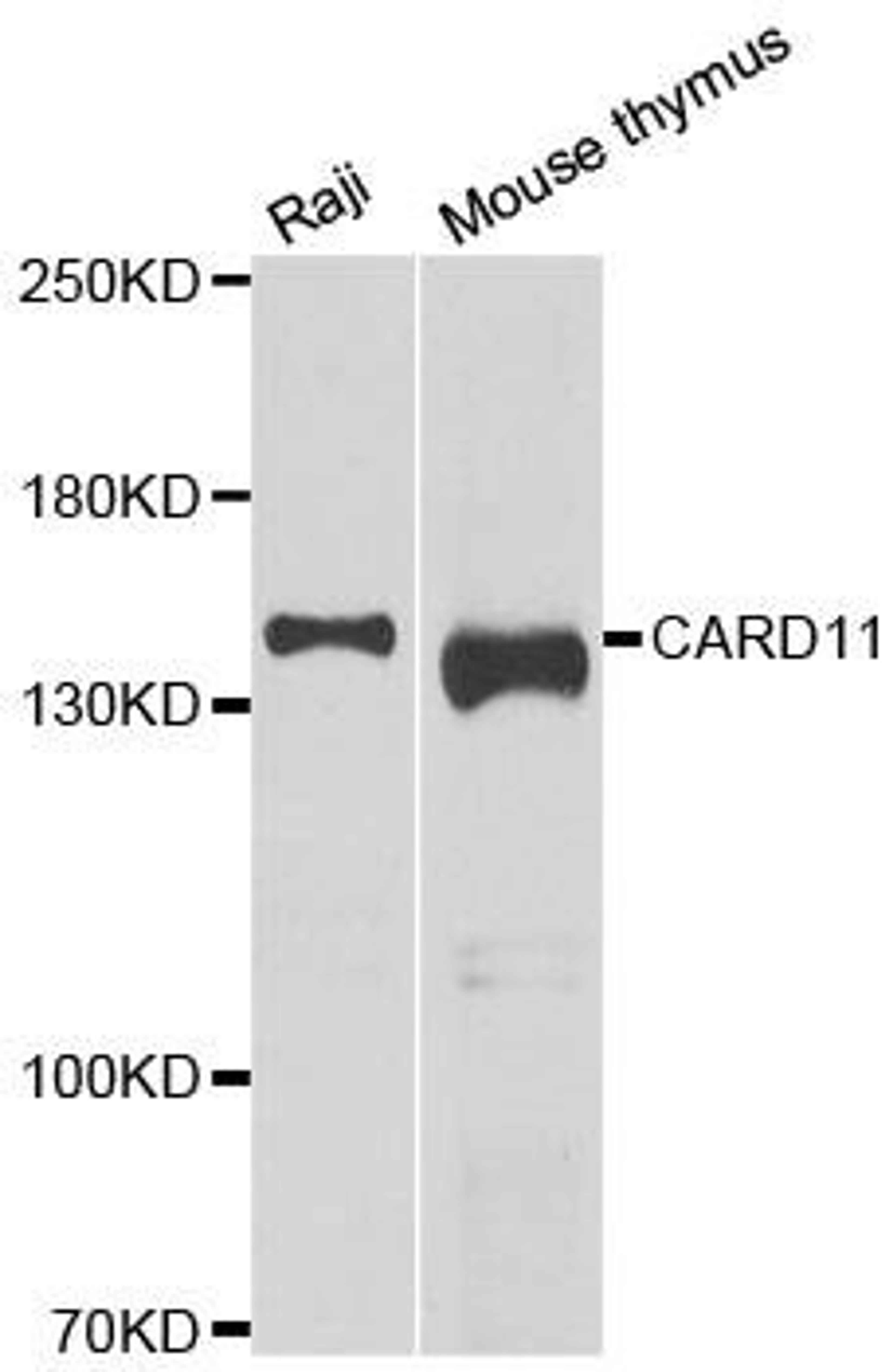 Western blot analysis of extracts of various cell lines using CARD11 antibody