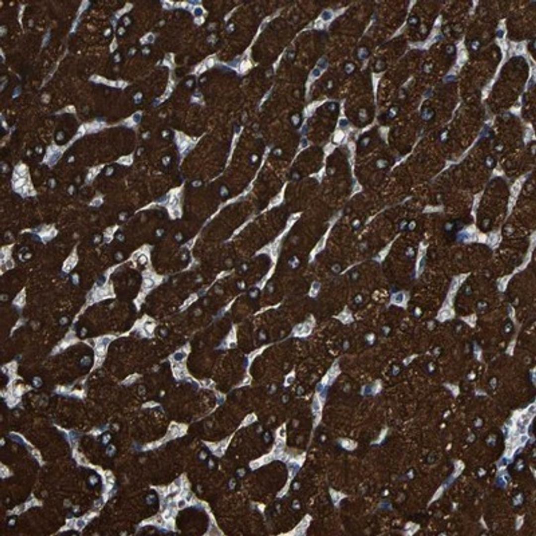 Immunohistochemistry-Paraffin: CES1 Antibody [NBP1-85691] - Staining of human liver shows strong cytoplasmic positivity in hepatocytes.