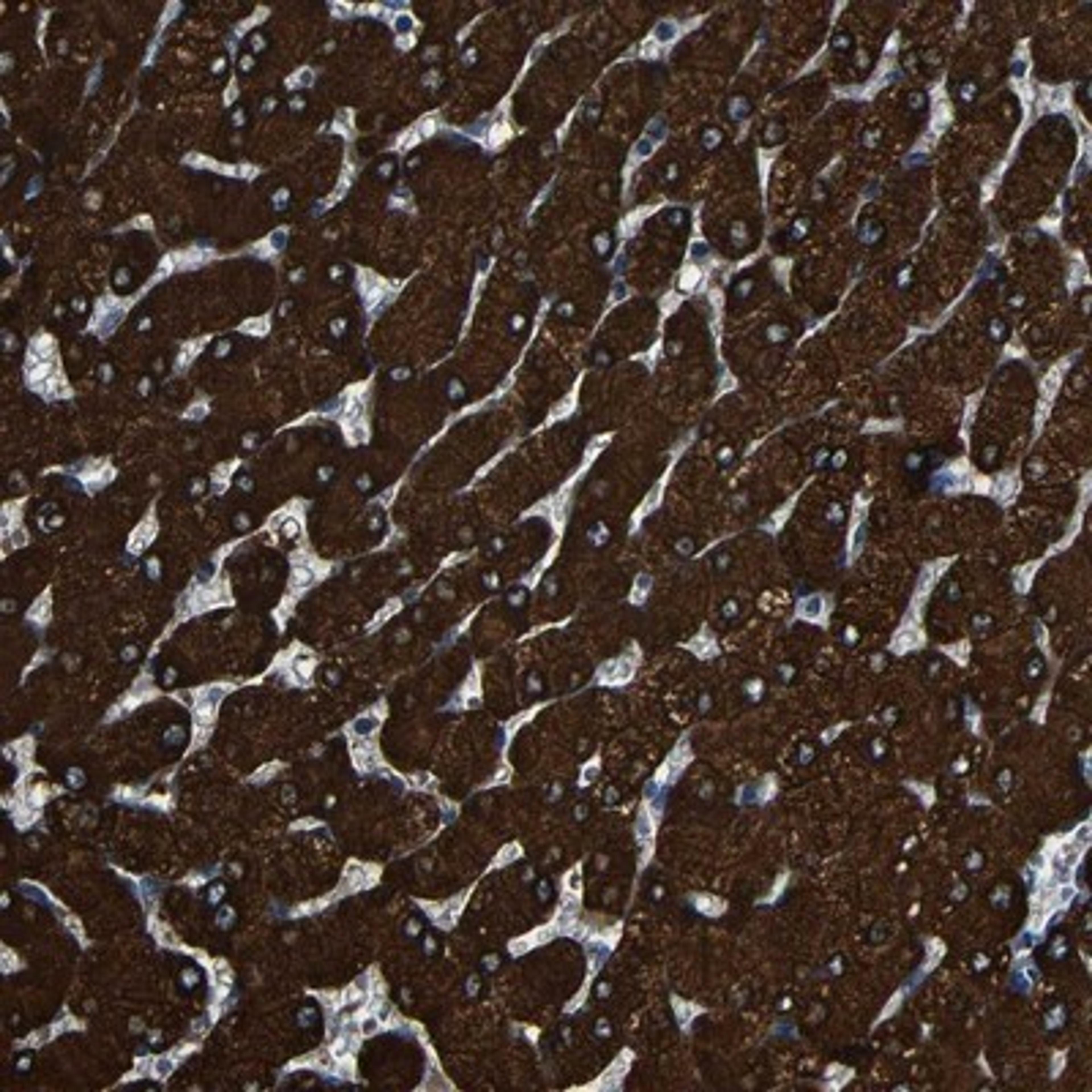 Immunohistochemistry-Paraffin: CES1 Antibody [NBP1-85691] - Staining of human liver shows strong cytoplasmic positivity in hepatocytes.