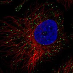 Immunocytochemistry/Immunofluorescence: PMP70 Antibody (CL2524) [NBP2-36770] - Staining in HeLa cell line with Anti-ABCD3 monoclonal antibody, showing specific staining of peroxisomes in green. Microtubule- and nuclear probes are visualized in red and blue respectively (where available). Antibody staining is shown in green.