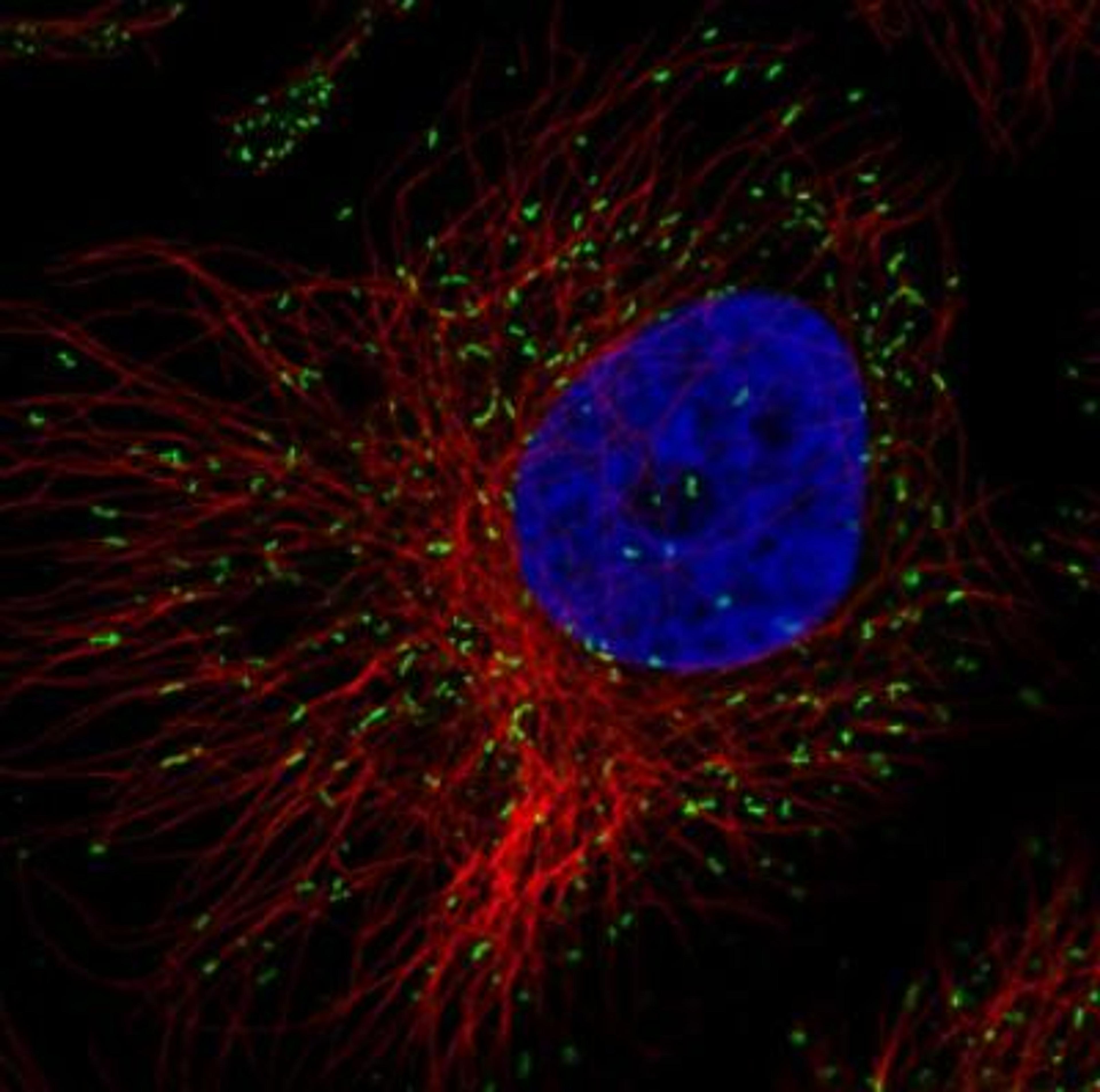 Immunocytochemistry/Immunofluorescence: PMP70 Antibody (CL2524) [NBP2-36770] - Staining in HeLa cell line with Anti-ABCD3 monoclonal antibody, showing specific staining of peroxisomes in green. Microtubule- and nuclear probes are visualized in red and blue respectively (where available). Antibody staining is shown in green.