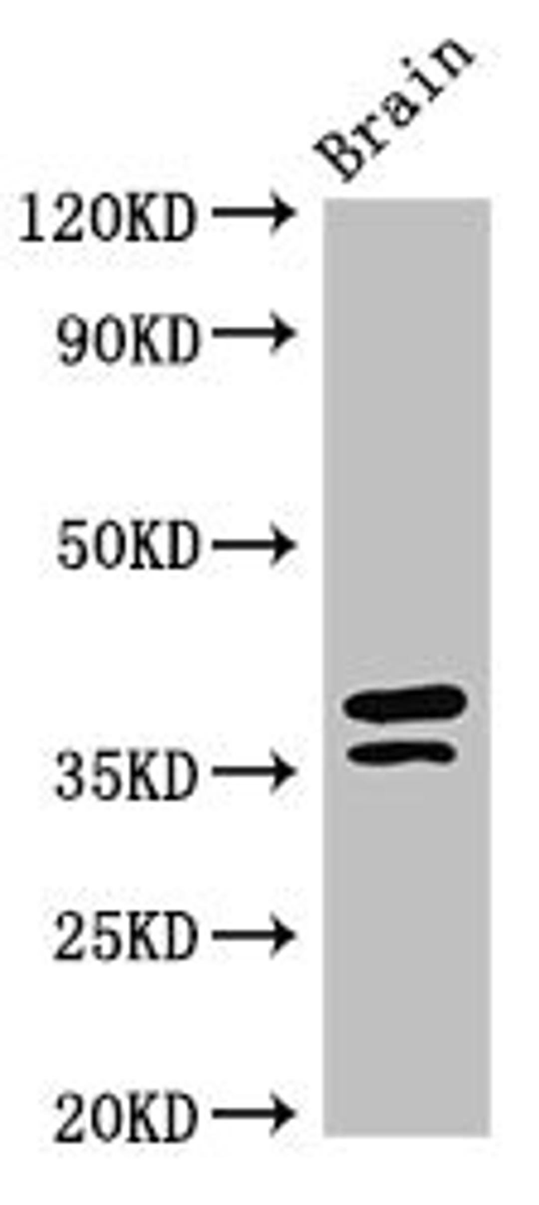 Western Blot. Positive WB detected in: Mouse brain tissue. All lanes: MAPRE2 antibody at 3ug/ml. Secondary. Goat polyclonal to rabbit IgG at 1/50000 dilution. Predicted band size: 38, 30, 36, 33, 31 kDa. Observed band size: 38, 36 kDa.