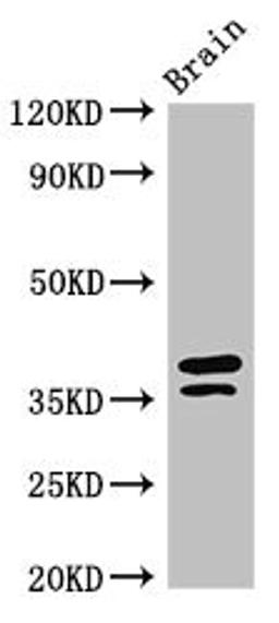 Western Blot. Positive WB detected in: Mouse brain tissue. All lanes: MAPRE2 antibody at 3ug/ml. Secondary. Goat polyclonal to rabbit IgG at 1/50000 dilution. Predicted band size: 38, 30, 36, 33, 31 kDa. Observed band size: 38, 36 kDa.