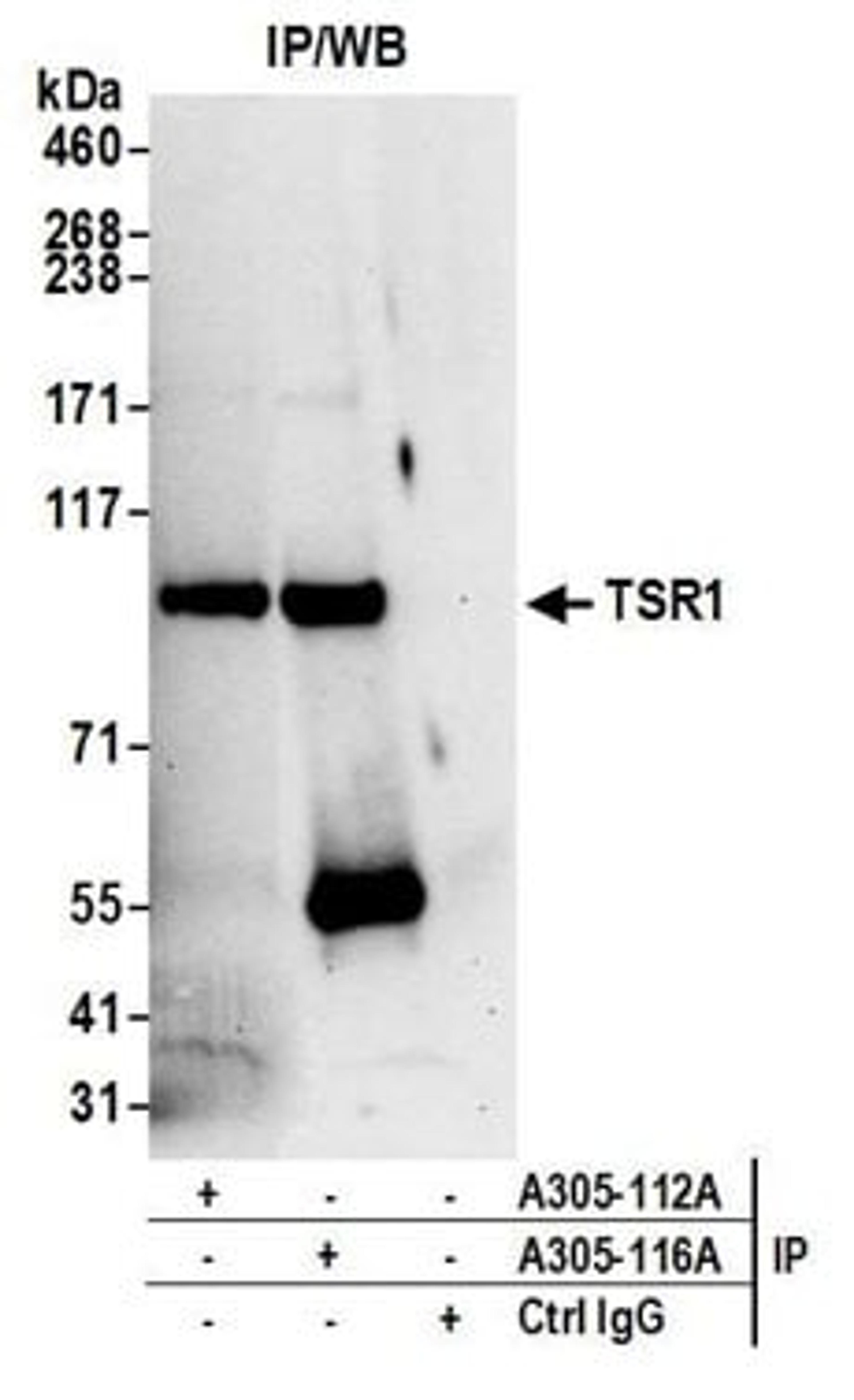 Detection of human TSR1 by western blot of immunoprecipitates.