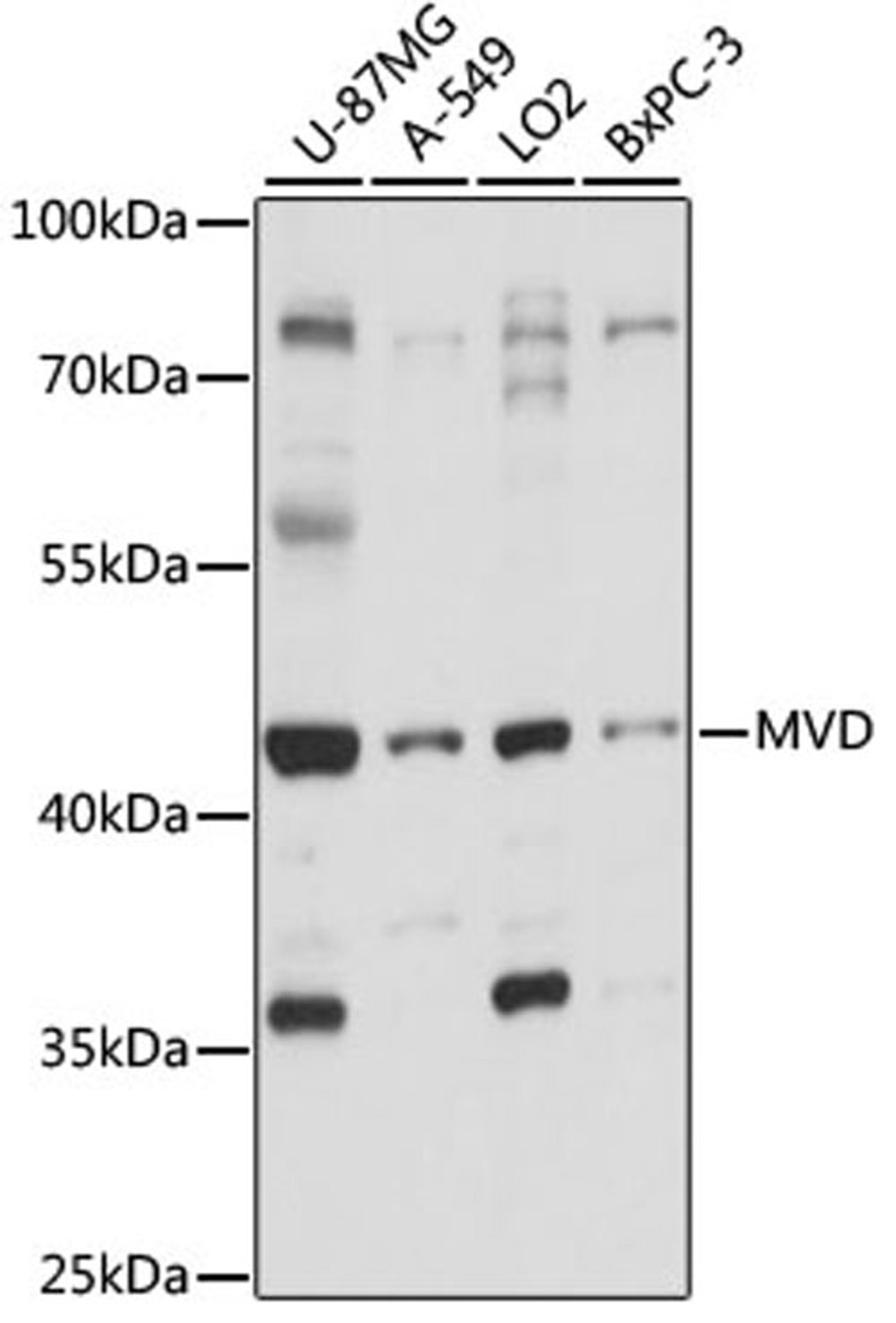 Western blot - MVD antibody (A15240)