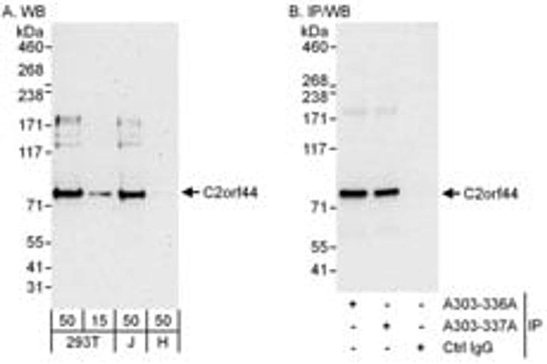 Detection of human C2orf44 by western blot and immunoprecipitation.