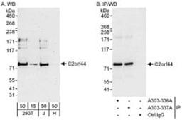 Detection of human C2orf44 by western blot and immunoprecipitation.