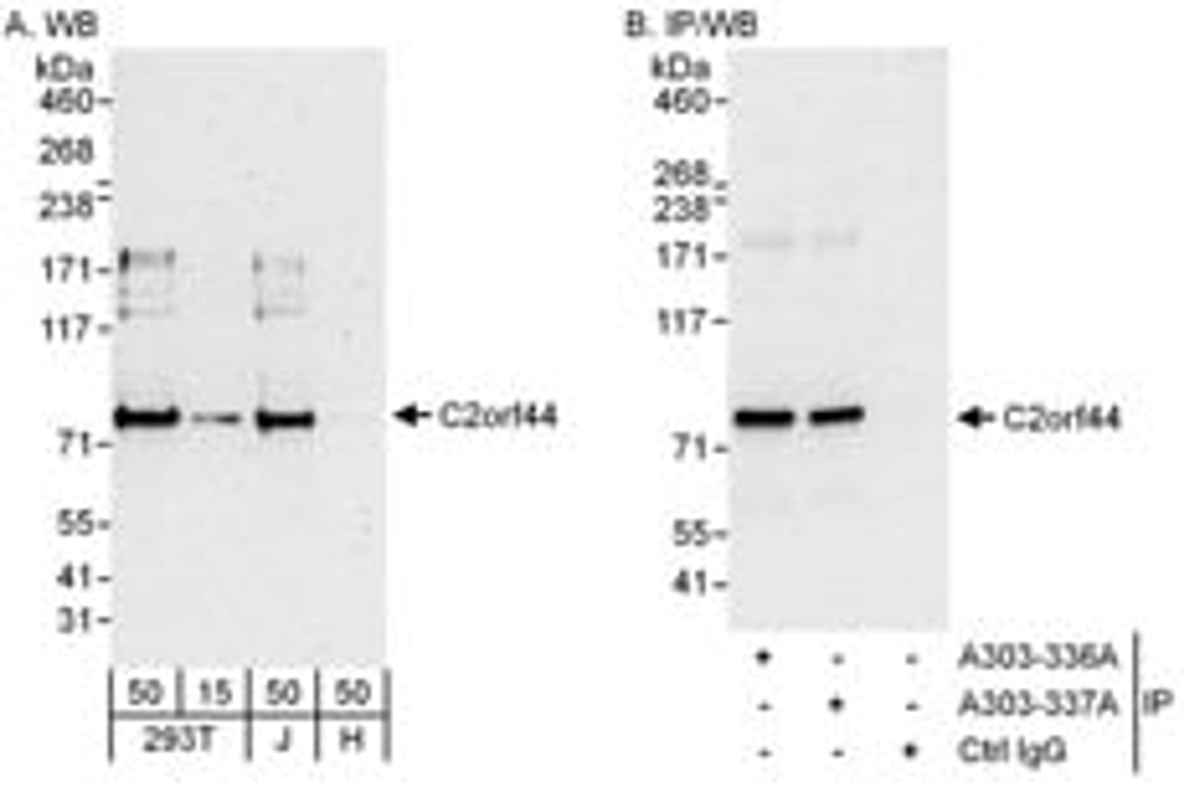 Detection of human C2orf44 by western blot and immunoprecipitation.