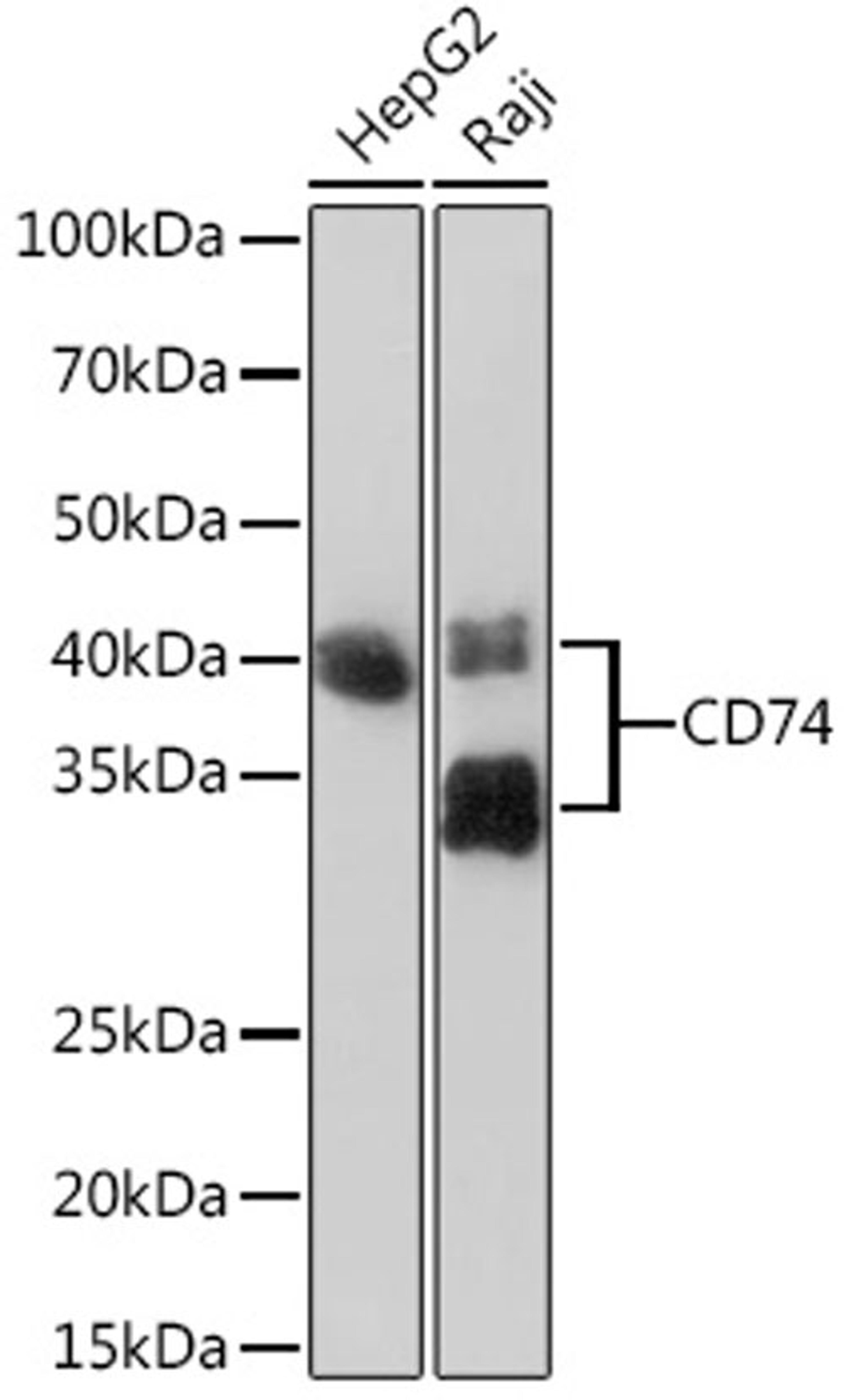 Western blot - CD74 Rabbit mAb (A9149)