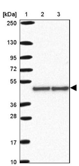 Western Blot: hnRNP G Antibody [NBP2-34152] - Lane 1: Marker [kDa] 250, 130, 95, 72, 55, 36, 28, 17, 10<br/>Lane 2: Human cell line RT-4<br/>Lane 3: Human cell line U-251MG sp