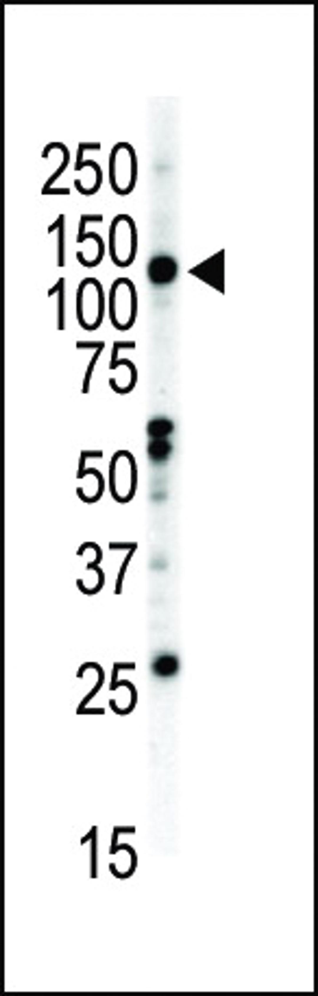 Western blot analysis of anti-EphB2 C-term Pab in NCI-H460 cell lysate