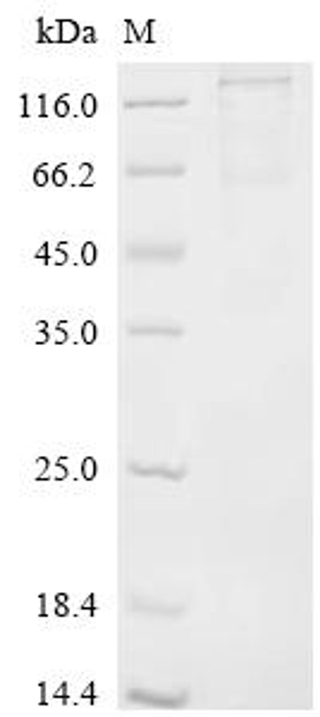 (Tris-Glycine gel) Discontinuous SDS-PAGE (reduced) with 5% enrichment gel and 15% separation gel.